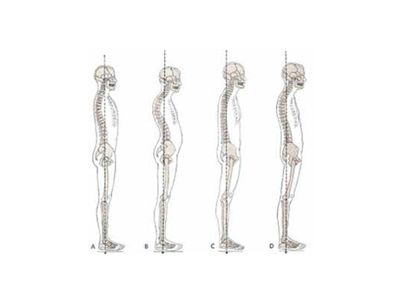 Good Posture or Dynamic Balance?