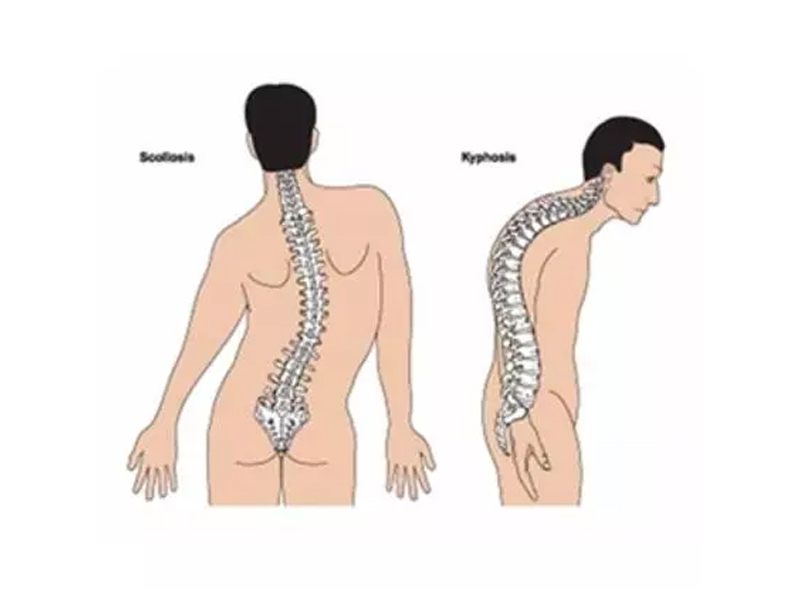 Spine Health and Alternative Core Exercises